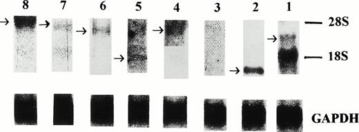 Fig. 1. Northern blot analysis of the expression of the eight isolated sequences in the primary leukemia cells. Signals were obtained using probes derived from clones no. 1, 2, 4, 5, 6, 7, and 8. The level of gene expression of these seven clones was variable compared with signals obtained from a control probe, GAPDH.