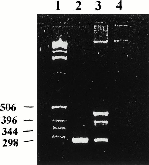 Fig. 2. RT-PCR analysis for the expression of clone no. 3 (lane 1, molecular marker; lane 2, positive control consisted of PCR amplification of a recombinant plasmid containing sequence 3; lane 3, RT-PCR amplification of total RNA isolated from the primary leukemia cells; lane 4, negative control). Clone no. 3 PCR primer sequences were as follows: clone no. 3-1, 5′-CAA AGA AGA TCC TGA TGG-3′; clone no. 3-2, 5′-GCA GTG CAT TGG TCT ATC-3′.