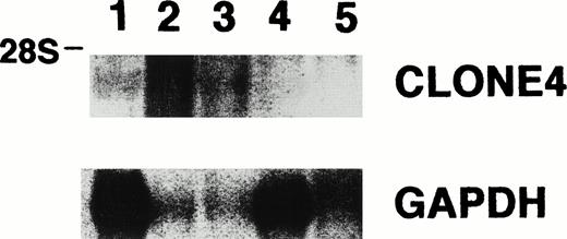 Fig. 3. Northern blot analysis for the expression of clone no. 4 and GAPDH, showing clone no. 4 mRNA in leukemia cells derived from two of the four other CML patients (lane 1, RNA from leukemia cells derived from patient C.D.; lanes 2, 3, 4, and 5, RNA from leukemia cells derived from four other CML patients).