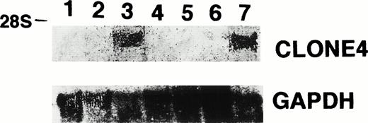 Fig. 4. Northern blot analysis for the expression of clone no. 4 and GAPDH in leukemia cell lines, normal bone marrow, and patient C.D., showing clone no. 4 mRNA in K562 cells (lane 1, P39; lane 2, Molt 4; lane 3, K562; lane 4, HEL; lane 5, CEM; lane 6, normal bone marrow; lane 7, patient C.D.).