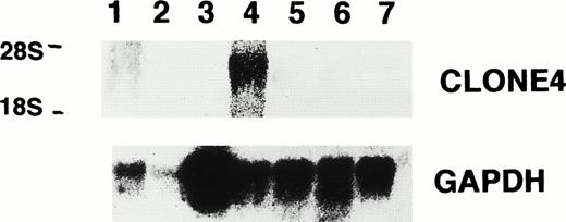 Fig. 5. Northern blot analysis for the expression of clone no. 4 and GAPDH showing clone no. 4 mRNA in normal testis (lane 1, lungs; lane 2, spleen; lane 3, muscle; lane 4, testis; lane 5, small intestine; lane 6, brain; lane 7, normal bone marrow).
