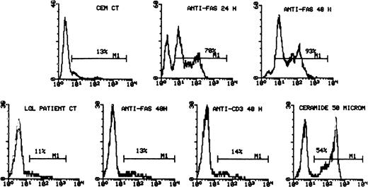 Fig. 3. Freshly isolated LGL are resistant to CD95 and anti-CD3–mediated apoptosis. CEM-sensitive cell line was used as a positive control for CD95-induced apoptosis (top panel). The cells were incubated with media alone (histograms on the left) or with anti-CD95 (CH11, 1 μg/mL) for 24 and 48 hours, as shown. The cells were then stained with 7-AAD and analyzed by flow cytometry. The LGL leukemic cells are analyzed in the bottom panel. The percentage of apoptotic cells is indicated in each histogram. Although leukemic LGL were resistant to both anti-CD95– and anti-CD3–induced apoptosis (BC3, 10 μg/mL), they remained susceptible to ceramide.