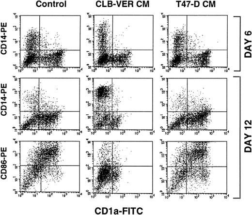 Fig. 1. Inhibition of the differentiation of DC from CD34+ progenitors by RCC CM. CD34+progenitors were incubated with GM-CSF+TNF alone or in the presence of 10% of RCC CM or breast CM (control). Medium was replaced at days 6 and 10. A double staining with CD14-PE and CD1a-FITC antibodies was performed at day 6. At day 12, cells were labeled with CD14-PE/CD1a-FITC or CD86-PE/CD1a-FITC and analyzed on a FACScan (Becton Dickinson). Results are of one representative experiment performed with different seven CD34+ cells samples.