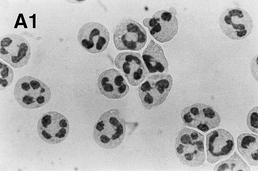 Fig. 4. PMA treatment of neutrophils results in rapid morphologic changes accompanied by externalization of PS. (A) Cytospin preparation of neutrophils cultured in medium alone (1) or treated for 3 hours with 200 nmol/L PMA (2). Note the presence of numerous vacuoles in the cytoplasm and the coalescence of the nuclear lobes after PMA treatment. Original magnification × 100. (B) PS exposure in unstimulated (panel 1) and PMA-treated (panel 2, 200 nmol/L) neutrophils after 3 hours of culture. PS exposure was determined by flow cytometric analysis of annexin V binding as described in Materials and Methods. The percentage PS exposure is indicated. PMA treatment also caused a marked increase in forward scatter of these cells, indicative of an increase in cell size (data not shown). Similar results were obtained with three independent donors.
