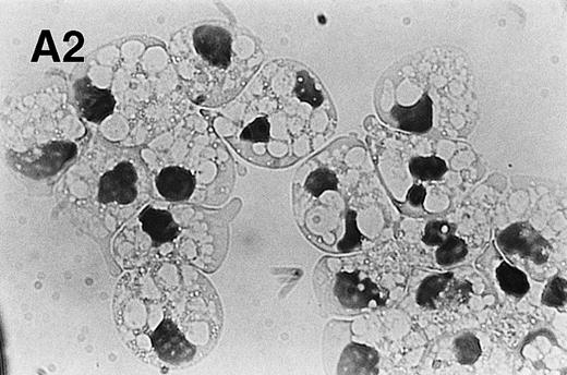 Fig. 4. PMA treatment of neutrophils results in rapid morphologic changes accompanied by externalization of PS. (A) Cytospin preparation of neutrophils cultured in medium alone (1) or treated for 3 hours with 200 nmol/L PMA (2). Note the presence of numerous vacuoles in the cytoplasm and the coalescence of the nuclear lobes after PMA treatment. Original magnification × 100. (B) PS exposure in unstimulated (panel 1) and PMA-treated (panel 2, 200 nmol/L) neutrophils after 3 hours of culture. PS exposure was determined by flow cytometric analysis of annexin V binding as described in Materials and Methods. The percentage PS exposure is indicated. PMA treatment also caused a marked increase in forward scatter of these cells, indicative of an increase in cell size (data not shown). Similar results were obtained with three independent donors.