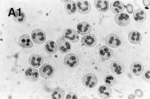 Fig. 1. Spontaneous and Fas/APO-1–mediated apoptosis of freshly isolated human neutrophils. (A) Cytospin preparations of neutrophils were stained with hematoxylin/eosin and apoptotic cells were quantified morphologically: (1) medium alone 0 hour, (2) medium alone 6 hours, (3) anti-Fas MoAb 250 ng/mL 6 hours, (4) medium alone 24 hours. Bold arrows indicate typical cells in the intermediate stages of apoptosis. Percentages of apoptotic cells are reported in Table 1. (B) Agarose gel electrophoresis of DNA showing a time-dependent increase in the formation of oligonucleosomal DNA fragments in spontaneous (lane 1, 0 hour; lane 2, 3 hours; lane 3, 6 hours; lane 4, 12 hours; lane 5, 24 hours) and Fas/APO-1–triggered (lane 6, 3 hours; lane 7, 6 hours; lane 8, 12 hours) apoptosis. Lane M represents molecular weight marker (kB). (C) Flow cytometric analysis of annexin V binding in neutrophils undergoing spontaneous (panel 1, 6 hours; panel 2, 24 hours) and Fas/APO-1–mediated (panel 3, 6 hours; panel 4, 24 hours) apoptosis. The percentage of PS positive cells in each sample is indicated. Similar results were obtained in four separate donors (see Table 1).