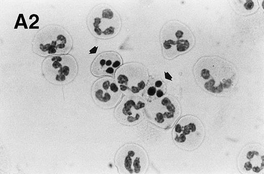 Fig. 1. Spontaneous and Fas/APO-1–mediated apoptosis of freshly isolated human neutrophils. (A) Cytospin preparations of neutrophils were stained with hematoxylin/eosin and apoptotic cells were quantified morphologically: (1) medium alone 0 hour, (2) medium alone 6 hours, (3) anti-Fas MoAb 250 ng/mL 6 hours, (4) medium alone 24 hours. Bold arrows indicate typical cells in the intermediate stages of apoptosis. Percentages of apoptotic cells are reported in Table 1. (B) Agarose gel electrophoresis of DNA showing a time-dependent increase in the formation of oligonucleosomal DNA fragments in spontaneous (lane 1, 0 hour; lane 2, 3 hours; lane 3, 6 hours; lane 4, 12 hours; lane 5, 24 hours) and Fas/APO-1–triggered (lane 6, 3 hours; lane 7, 6 hours; lane 8, 12 hours) apoptosis. Lane M represents molecular weight marker (kB). (C) Flow cytometric analysis of annexin V binding in neutrophils undergoing spontaneous (panel 1, 6 hours; panel 2, 24 hours) and Fas/APO-1–mediated (panel 3, 6 hours; panel 4, 24 hours) apoptosis. The percentage of PS positive cells in each sample is indicated. Similar results were obtained in four separate donors (see Table 1).