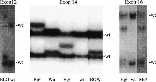 Fig. 1. Detection of seven SSCPs. SSCP screening detected polymorphisms in exon 12 in genomic DNA from the ELO heterozygote, four polymorphisms in exon 14, and two polymorphisms in exon 16. Two normal bands (n) visible in wild-type (wt) homozygotes correspond to complementary strands of PCR-amplified DNA. Heterozygosity is reflected by the presence of an additional 1 to 2 bands.
