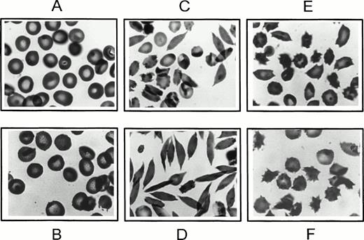 Fig. 2. Morphology of newly formed dense cells. After 22 hours at pH 6.8 in 5% CO2-equilibrated buffer, as in Fig 1 (for B-F), cells were oxygenated for 30 minutes with 100% oxygen, fixed in glutaraldehyde, and examined by light microscopy. (A) Uncycled parent SS ND cells; (B) SS ND cells exposed to continuous oxygenation for 22 hours; (C) top density cell fraction (<1.10 g/mL) formed after 22 hours of O-D cycling; (D) bottom density cell fraction (>1.10 g/mL) formed after 22 hours of O-D cycling; (E) top density cell fraction (<1.10 g/mL) formed after 22 hours of continuous deoxygenation; and (F) bottom density cell fraction (>1.10 g/mL) formed after 22 hours of continuous deoxygenation.