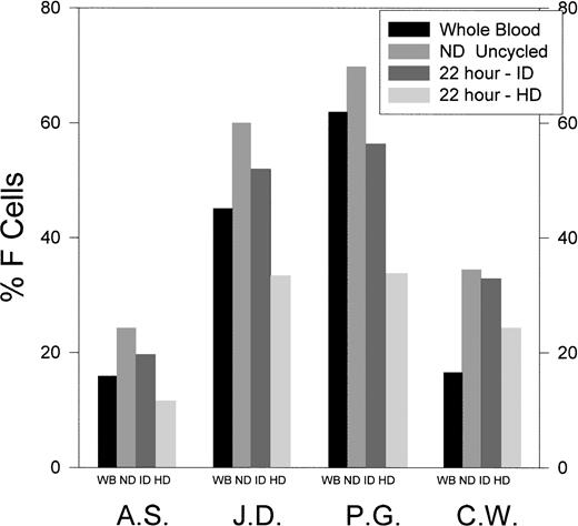 Fig. 4. The percentage of F cells in unfractionated, ND uncycled, and ID and HD cells formed after 22 hours of O-D cycling at pH 6.8. SS ND cells derived from SS whole blood (WB) were O-D cycled for 22 hours at pH 6.8, and the newly formed dense cells were separated into ID and HD cells using continuous density gradients, as in Fig 1. Results are shown for four SS patients.