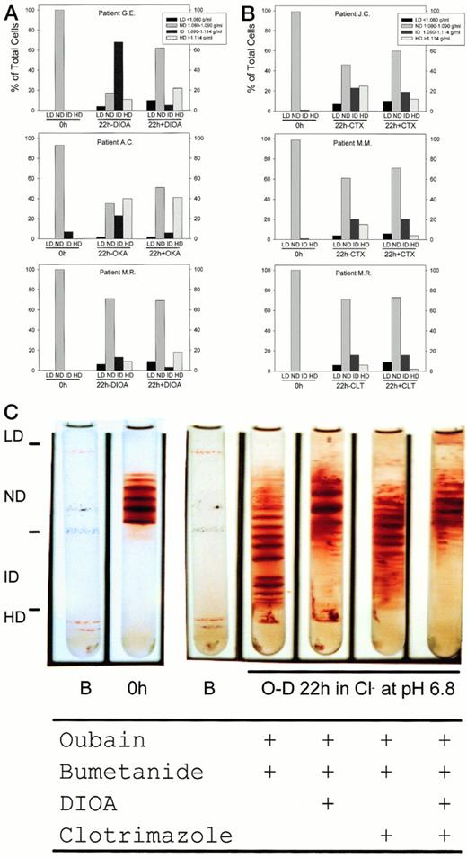 Fig. 6. Effect of ion transport inhibitors on dense cell formation by O-D cycling. SS ND cells were O-D cycled for 22 hours at pH 6.8 and density separated into LD, ND, ID, and HD fractions, and the percentage of cells in each fraction was quantitated as described and defined in Fig 1. All experiments contained ouabain (100 μmol/L final concentration) and bumetanide (10 μmol/L final concentration) to inhibit the Na+-K+-ATPase and Na+-K+-2Cl− cotransporter, respectively. (A) Inhibitors of K:Cl cotransport, DIOA (100 μmol/L final concentration), and okadaic acid (OKA; 0.5 μmol/L final concentration) primarily inhibited ID cell formation (1.090 to 1.114 g/mL). (B) Inhibitors of K(Ca2+), charybdotoxin (CTX; 0.1 μmol/L final concentration), and clotrimazole (CLT; 10 μmol/L final concentration) inhibited primarily HD cell formation (>1.114 g/mL). (C) Combined use of K:Cl cotransport inhibitor (DIOA) and K(Ca2+) inhibitor (CLT) in the same SS patient on ID and HD cell formation. Inhibitor concentrations are as described above. A manifold was used to allow for the simultaneous O-D cycling of all four test conditions.