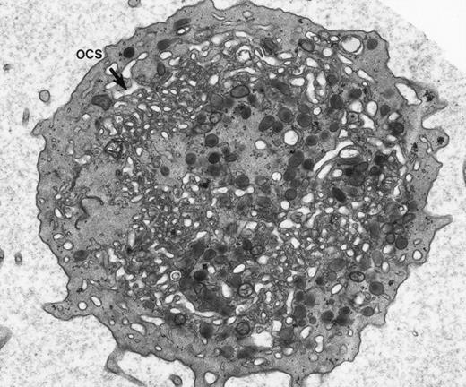 Fig. 1. Giant platelet from peripheral blood of a patient with May-Hegglin anomaly. Channels of the surface-connected OCS are usually dilated in these large cells. (Original magnification ×20,000.)