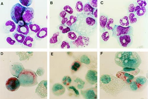 Fig. 4. Cytological analysis of hematopoietic colonies. Cells were recovered from G-CSF–stimulated methylcellulose cultures of WT- (A and D), d716- (B and E), or GEpoR- (C and F) transduced cells. Cells were analyzed by Wright stain (A through C) or chloroacetate esterase stain (D through F). Shown are representative results of one of four experiments. Original magnification × 1,110.