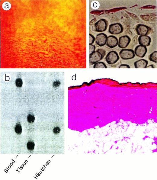 Fig. 3. PCR genotyping for determination of origin of silver-nitrate-stained endothelial cells. (a) Polygonal endothelial cells identified on Dacron grafts after silver nitrate staining. (b) PCR genotyping of silver nitrate-stained endothelial cells demonstrating bone marrow origin. (c) Endothelial cells stained positive for CD34 antigen. (d) Hematoxylin and eosin staining of silver nitrate-stained section.