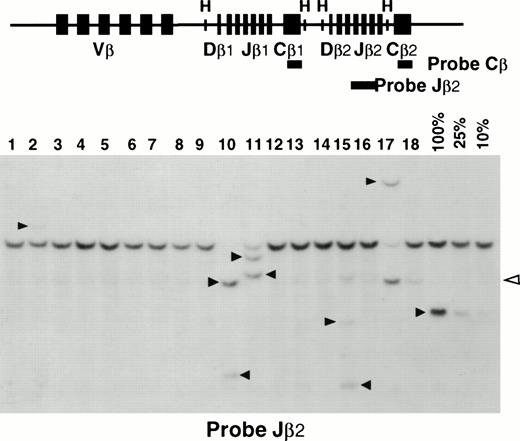 Fig. 4. Analysis of Tcrb rearrangements. (Upper panel) A schematic representation of the murine Tcrb gene is shown with its Vβ, Dβ, Jβ, and Cβ segments. The relevant HindIII sites (H) are shown. The Jβ2 and Cβ probes are shown as thick lines. (Lower panel) An example of Southern blot analysis is shown. Mouse splenic DNAs are analyzed on lanes 1 through 18. Quantification of the clonal rearrangements is made by comparison to a serial dilution of tumoral DNA into normal spleen DNA (100%, 25%, and 10%) included on each membrane. Black arrows indicate the clonalTcrb rearrangements. The open arrow shows incomplete DJ rearrangements that were not taken into account. Samples in lanes 9, 10, and 17 demonstrated major tumor loads. Samples in lanes 2 and 15 demonstrated minor tumoral loads.