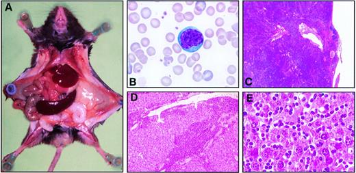 Fig. 2. Histopathological analysis of the CD2-p13 mice. (A) Macroscopic view of a F4 CD2-p13 transgenic mouse showing an enlarged spleen of 1,100 mg. (B) Photomicrography of a typical T-cell prolymphocyte from a F4 CD2-p13 transgenic mouse. The blood smear was stained with May-Grünwaltd-Giemsa. (C through E) Histology of spleen (C) and liver (D and E) after hematoxylin-eosin staining. (C) The spleen has lost its normal architecture and is infiltrated by prolymphocytes beyond its capsule. (D) Low magnification of the liver showing large amounts of prolymphocytes surrounding portal tracts. (E) High magnification of the liver showing numerous prolymphocytes within sinusoids.