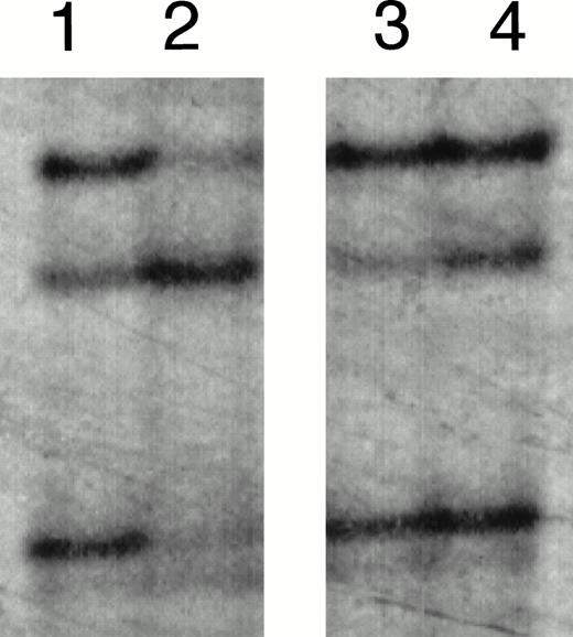 Fig. 3. SSCP analysis of E2E4 segments amplified from the patients (cases no. 1 and 2) at the initial onset. Lanes 1 and 4, HL-60 without mutation; lanes 2 and 3, cases no. 1 and 2 at the initial onset, respectively.