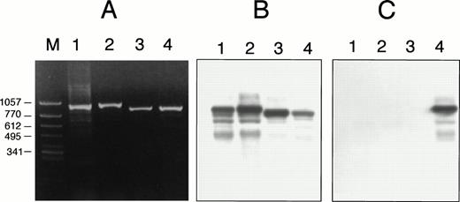 Fig. 6. Detection of A889T by ASO hybridization in case no. 2. Using a control sample (ATRA-sensitive APL cells with a short PML/RARα isoform) (lanes 1 and 3) and case no. 2 (lanes 2 and 4), DNA segments amplified differentially from RARα (lanes 1 and 2) or PML/RARα chimeric gene (lanes 3 and 4). (A) Ethidium bromide staining of agarose gel electrophoresis. (B) The membrane blotted from (A) was hybridized with oligonucleotide probe specific for the wild-type sequence. (C) The membrane same as (B) was hybridized with oligonucleotide probe for A889T. The sequence of wild-type probe was 5′-CGGACCCAGATGCACAACGC-3′, the center adenine of which was replaced with thymidine in the mutant probe. The mutant probe positively hybridized only to the DNA segment that was amplified from PML/RARα chimeric gene of case no. 2 (lane 4).