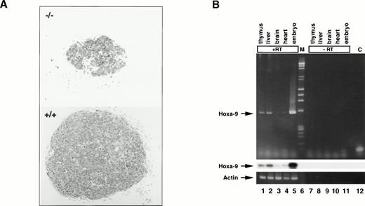 Fig. 2. Hoxa-9 in day-15.5 fetal thymuses. (A) Microphotographs of sections of mutant (top) and normal (bottom) day-15.5 fetal thymuses stained with methylene blue (original magnification × 150). Sections were taken through the midportion of each gland. (B) Hoxa-9 gene expression in normal fetal thymus. RT-PCR using primers specific for Hoxa-9 was performed on day-15.5 fetal tissues and the amplified cDNAs probed for Hoxa-9by Southern blot analysis. Lanes 1 through 5 with RT; lane 1, thymus; lane 2, liver; lane 3, brain; lane 4, heart; lane 5, whole embryo; lane 6, markers (M); lanes 7 through 11, same tissues with no RT; lane 12, control (C) with no DNA. Strong signal is seen in lanes 1 and 2, representing fetal thymus and liver, respectively. (Upper panel) Ethidium bromide staining. (Middle panel) Southern blotting forHoxa-9. (Lower panel) Actin control.