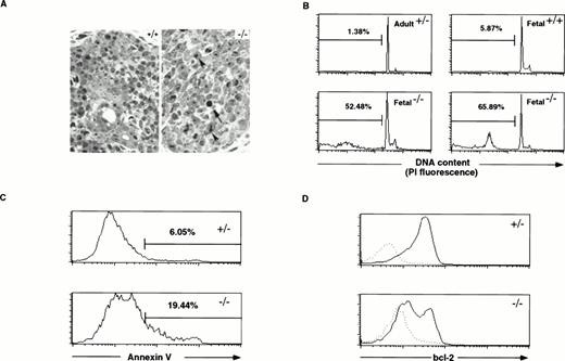 Fig. 7. Increased cell death in Hoxa-9−/−fetal thymuses. (A) Microphotographs of sections of mutant (right) and normal (left) day-15.5 fetal thymuses stained with methylene blue (original magnification × 560). The arrow points to a pyknotic nucleus and the arrow heads mark areas of chromatin condensation. (B) Day-15.5 Hoxa-9−/− thymocytes show a marked increase in hypodiploid nuclei by propidium iodide staining and FACS analysis. The percentage of hypodiploid nuclei in mutant thymuses is dramatically increased (lower two panels) as compared with control adult and fetal thymuses (upper two panels). (C) Annexin V staining of fetal thymocytes. Mutant thymuses (n = 7) show an approximate threefold increase in the percentage of cells binding high levels of annexin V as compared with control animals (n = 10), as well as significant increases in the fraction binding intermediate levels. (D) Bcl-2 protein levels in day-15.5 thymocytes. Control thymocytes (n = 12) show high levels in bcl-2 protein in nearly all cells, whereas half of the Hoxa-9−/− thymocytes (n = 4) show markedly reduced levels of bcl-2 (solid lines). Dotted lines depict staining with hamster IgG-PE as a negative control.