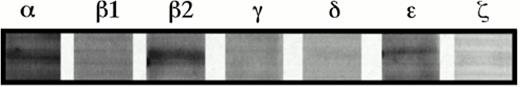 Fig. 2. PKC isoform expression in TF-1 cells. TF-1 whole cell lysates were analyzed for expression of PKCα, β1, β2, γ, δ, , and ζ isoforms by immunoblotting. This is a representative blot of two experiments.