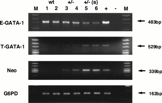 Fig. 6. RNA analysis of wild-type and heterozygous mutant female spleens. Expression of GATA-1 from either the IE promoter (E-GATA-1) or the IT promoter (T-GATA-1) was examined after 35 cycles of amplification using 5′ primers specific for either first exon and a 3′ primer used in common in the GATA-1 third exon. Expression of neomycin phosphotransferase was also examined after 35 cycles of amplification. G6PD was used as the internal control and analyzed after 27 cycles of amplification. The numbers indicate individual animals. Lanes 1 and 2, samples isolated from wild-type spleens; lanes 3 and 4, heterozygous mutant female spleens in animals displaying mild splenomegaly; lanes 5 and 6, heterozygous mutant female spleens having marked splenomegaly. +, positive control; −, no template added; M, marker lane.