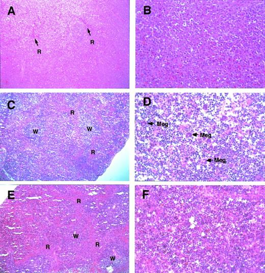 Fig. 3. Histological appearance of the spleen from theGATA-1.05 heterozygous mutant and wild-type female mice. Histological sections of the spleens from GATA-1.05heterozygous female mice with severe splenomegaly (A and B;GATA-1.05 heterozygous mouse no. 12 in Table 1) or mild splenomegaly (C and D; heterozygous animal no. 3 in Table 1) are shown. Red pulp (R), white pulp (W), and megakaryocytes (Meg) are indicated. The histological sections of wild-type female mouse spleen (E and F; corresponding to wild-type no. 1 in Table 1) are also shown. Tissues were stained with hematoxyline and eosin. Original magnifications × 20 (A, C, and E) or × 80 (B, D, and F).