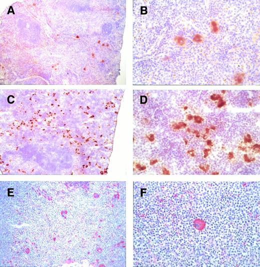 Fig. 4. Acetylcholinesterase and anti-glycoprotein IIb staining of megakaryocytes in the spleens of female mice. Megakaryocytes in a heterozygous mutant spleen (C and D) were positive for acetylcholinesterase staining. The appearance of the positive staining cells is morphologically similar to megakaryocytes in a wild-type spleen (A and B). Note that there are more megakaryocytes in the mutant mouse spleen. These cells were also positive for glycoprotein IIb (E and F). Original magnifications × 20 (A, C, and E) and × 80 (B, D, and F).