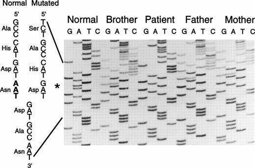 Fig. 3. Direct sequencing of amplified exon 8 DNA. The normal and mutated sequences are given on the left of the ladder. The missing nucleotides AAT between the positions 1030 and 1032 are shown in bold. The asterisk (*) indicates the position of the deletion.
