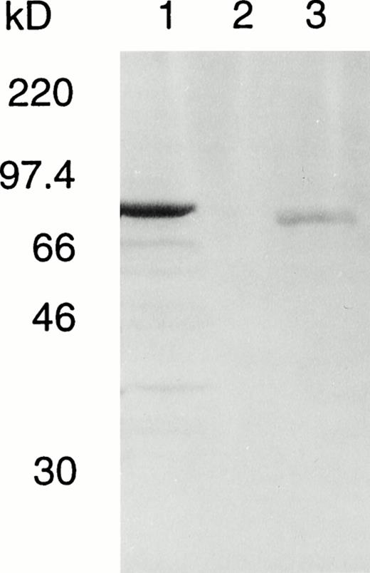 Fig. 5. Western blot of normal and deleted A subunits in fresh lysates of S cerevisiae AH22. Total yeast lysate protein was prepared from S cerevisiae transformed with lane 1, pGal181/wild-type factor XIII A-subunit cDNA (1.5 μg); lane 2, negative control vector pGal181 (1.5 μg); and lane 3, pGal181/Asn 344–deleted factor XIII A-subunit cDNA (6 μg). The samples were subjected to SDS-PAGE, blotted onto nitrocellulose membrane, and developed with antiserum to human factor XIII A subunit.