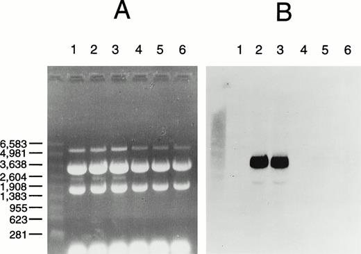 Fig. 6. RNA hybridization analysis of factor XIII A-subunit expression in yeast. (A) Ethidium bromide stained gel; (B) hybridized membrane. Total RNA was prepared from S cerevisiae AH22 transformed with negative control vector pGal181 (lanes 1, 4), pGal181/wild-type factor XIII A-subunit cDNA (lanes 2, 5), or pGal181/Asn344–deleted factor XIII A-subunit cDNA (lanes 3 through 6) and grown either in YPGal (induced; lanes 1 through 3) or YPD (repressed; lanes 4 through 6). Hybridization with a factor XIII A-subunit probe and chemiluminescent detection were performed as described in Materials and Methods. RNA size standards (Promega) on the left are in nucleotides.
