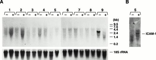 Fig. 8. Northern analysis of GP Ibα expression in mice administered LPS. As a model of gram-negative sepsis, LPS was administered to mice (colony 32) by intraperitoneal injection (25 mg/kg). As described in Fig 2, total RNA was prepared from treated (+) and control (−) mice. (A) Lanes 1 to 9 correspond to the same organs listed in the legend for Fig 2. Again, a visible GP Ibα transcript is only present in bone marrow (lane 9) with no increase in GP Ibα expression detected in any organ, but an absence of the GP Ibα bone marrow transcript 24 hours post-LPS treatment. (B) The nitrocellulose filter of (A) was rehybridized with an ICAM-1–radiolabeled cDNA fragment and confirmed an inflammatory state in the treated mice with an increase in the lung ICAM-1 mRNA (lane 5).