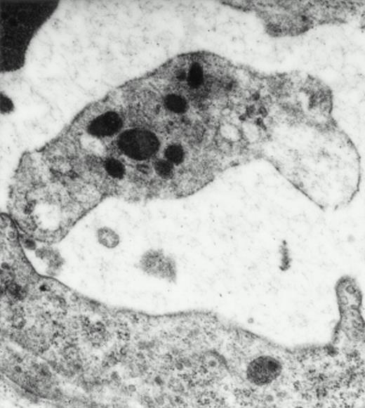 Fig. 3. Platelets in postischemic microvasculature visualized by electron microscopy. Electron microscopy demonstrated platelets attached to both endothelial cells (arrowhead) and neutrophils (arrows) in response to I/R (upper panel, original magnification × 3,000). Platelets bind directly to endothelial cells (lower panel, original magnification × 20,000).