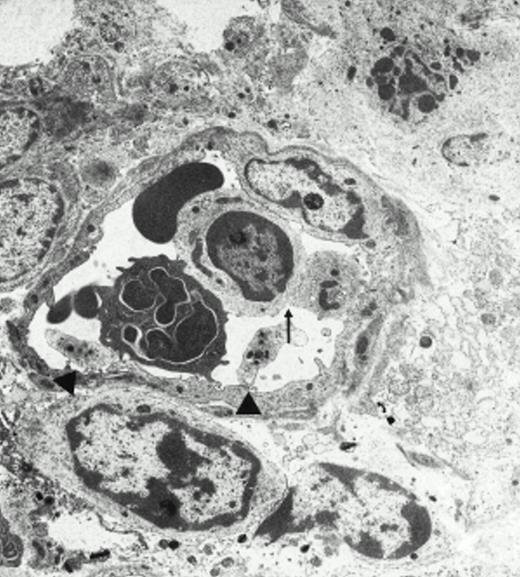 Fig. 3. Platelets in postischemic microvasculature visualized by electron microscopy. Electron microscopy demonstrated platelets attached to both endothelial cells (arrowhead) and neutrophils (arrows) in response to I/R (upper panel, original magnification × 3,000). Platelets bind directly to endothelial cells (lower panel, original magnification × 20,000).