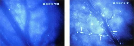 Fig. 2. I/R-induced platelet-endothelial cell interactions in vivo. Rhodamine-6G-labeled platelets are visualized within postcapillary venules using intravital fluorescence microscopy. Whereas few platelets adhere to the venular endothelium in sham-operated animals (group B, left panel), platelet attachment to the endothelium is significantly enhanced in response to I/R already 5 minutes after the onset of reoxygenation (group A, right panel, arrow). Original monitor magnification × 450.