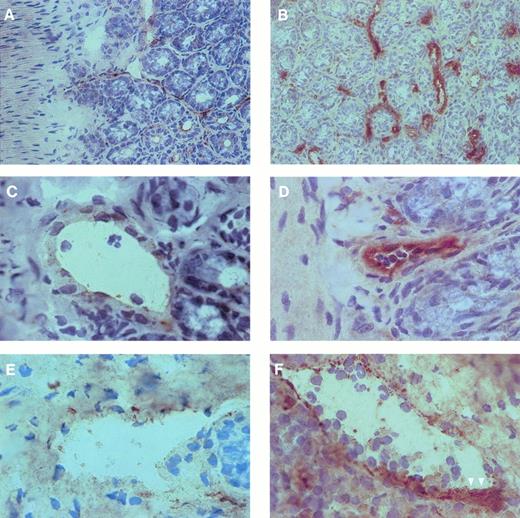 Fig. 4. P-selectin expression in arterioles and venules of mouse small intestine. Cryostat sections of intestinal specimens were incubated with a MoAb against P-selectin and stained using the peroxidase-antiperoxidase technique as described in the Materials and Methods. Counterstaining was performed using Mayer's hemalaun. In control animals (A, C, and E), P-selectin was weakly expressed by vascular endothelium of arterioles (C) and venules (E). In contrast, I/R (B, D, and F) markedly enhanced immunoreactivity for P-selectin in both arterioles (D) and venules (F). Formation of platelet aggregates, identified by an intense staining for P-selectin, was a prominent phenomenon after I/R (arrowheads). The magnification of the objective was 40× in (A) and (B) and 100× in (C) through (F), respectively.