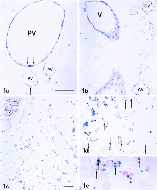 Fig. 1. Expression of P-selectin in rat liver 3 to 6 hours after the administration of LPS. Endothelial cells of the large portal vein (PV) and its branchings showed intense reaction to anti–P-selectin Ab (arrows; a). The endothelia of sublobular veins (V) and central veins (CV) also expressed P-selectin (b). P-selectin was also present along the walls of sinusoids and veins. A strong Ab reaction in the endothelia of central veins, as well as the pericentral sinusoids, was observed (c). The Ab reaction was relatively weak in the endothelium of periportal sinusoids but strong in adherent platelets (arrows, d), which were labeled by MoAb CD61 to platelet (arrows; e). Bars, a, b, and d = 50 μm; c = 50 μm; e = 10 μm.