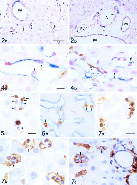 Fig. 2. Localization of P-selectin in intralobular area of the liver 3 to 6 hours after the administration of LPS. Immunostaining was with anti–P-selectin Ab (blue) and counterstaining was by nuclear fast red (red). Many platelets expressing P-selectin were found in the periportal area, correlating closely with the presence of PMNs (arrows; a). P-selectin was expressed on the endothelial cells of portal veins (PV), but not on ones of the periportal arteries (A; arrow) in the periportal tract (b). Bars = 40 μm.