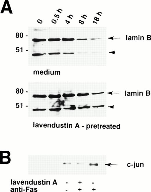 Fig. 5. Increased proteolytic cleavage of lamin B and phosphorylation of c-jun after stimulation of the Fas receptor are tyrosine kinase-dependent events in human eosinophils. (A) Freshly isolated lavendustin A (16 μg/mL) -pretreated and untreated eosinophils were stimulated with anti-Fas MoAb for the indicated times. The cell lysates were analyzed by immunoblotting with an antilamin B MoAb. A proteolytic fragment of lamin B (arrowhead) was already present in freshly purified eosinophils. After 8 hours, a reduction in the amount of lamin B was observed in untreated but not in lavendustin A-pretreated cells. The intensity (od-Bkg/mm2) of the lamin B signal was analyzed by densitometry. (Upper panel) 1,787 (100%), 1,626 (91%), 1,881 (105%), 775 (43%), and 496 (28%). (Lower panel) 1,459 (100%), 1,551 (106%), 1,375 (94%), 1,618 (111%), and 1,156 (79%). The position of molecular size standards (left). (B) Lavendustin A abrogated phosphorylation of c-Jun. Freshly isolated lavendustin A (16 μg/mL) -pretreated and untreated eosinophils were stimulated with anti-Fas MoAb for 60 minutes. The cell lysates were immunoprecipitated with an anti-JNK Ab, and phosphorylation of GST-c-Jun (1-79) was observed by an in vitro kinase assay. No increase in phosphorylation of c-Jun was found in lavendustin A-pretreated eosinophils, suggesting that tyrosine kinase(s) activation is essential for Fas receptor-mediated JNK activation. All data are from at least three independent experiments.