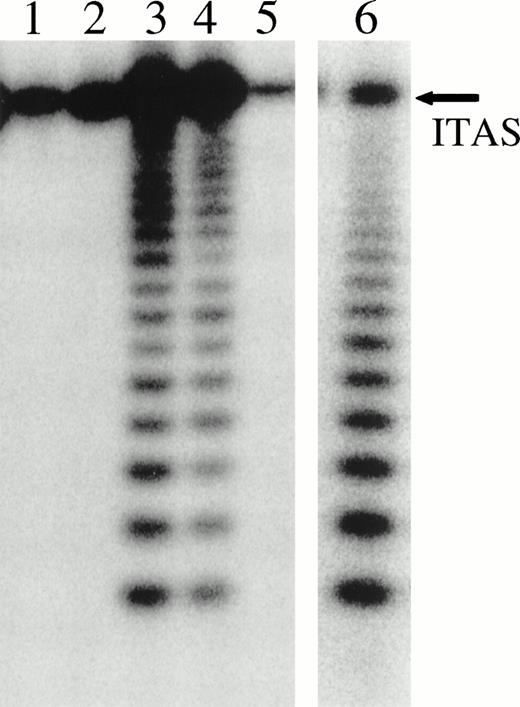 Fig. 4. Telomerase activity in HD samples and in an HD-derived cell line. The level of telomerase activity was analyzed at 0.28 μg/assay. Lanes 1, 2, and 5, HD samples with eosinophilia that exhibited undetectable telomerase activity. Lanes 3 and 4, 2 telomerase-positive HD samples without eosinophilia. Lane 6, the HD-derived cell line KM-H2. The amplification of ITAS was almost competed out by the telomerase products formed by KM-H2.