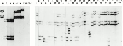Fig. 2. SSCP analysis of EBNA-1. EBNA-1 PCR products were first subcloned in a TA cloning vector. Independent clones were then analyzed for SSCP migrations. The sequence analysis of these subcloned fragments is given in Table 1. Lane numbers in the figure are also shown in Table 1. Migration pattern of 5 clones from NL 21 (lanes 1 through 5), 6 clones from NL 22 (lanes 6 through 11), 4 clones from NL 20 (lanes 12 through 16), 4 clones from NL 7 (lanes 17 through 21), 10 clones from NL 13 (lanes 22 through 31), and 8 clones from NL 4 (lanes 32 through 39) are shown. Control samples in the SSCP analysis include P-ala EBNA-1 amplified from B95.8 (lane B) and V-leu EBNA-1 amplified from P3HR1 (lane H). Several clones from the NLs migrate identically to the B95.8 pattern (eg, lanes 6, 9, 10, and 11 corresponding to clones 1, 5, 6, and 7, respectively, from NL 22).