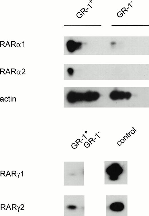 Fig. 1. Semiquantitative PCR analysis of RAR expression in differentiated granulocytes (Gr-1+) and other cell types (Gr-1−). Cells were separated as described in Materials and Methods. The PCR reaction was performed for 25 to 35 cycles for RARα1 and RARα2 and 50 cycles for RARγ and RARβ. Shown is a Southern blot analysis of the PCR product hybridized with an internal oligonucleotide probe specific for each amplification product, as described in Materials and Methods.