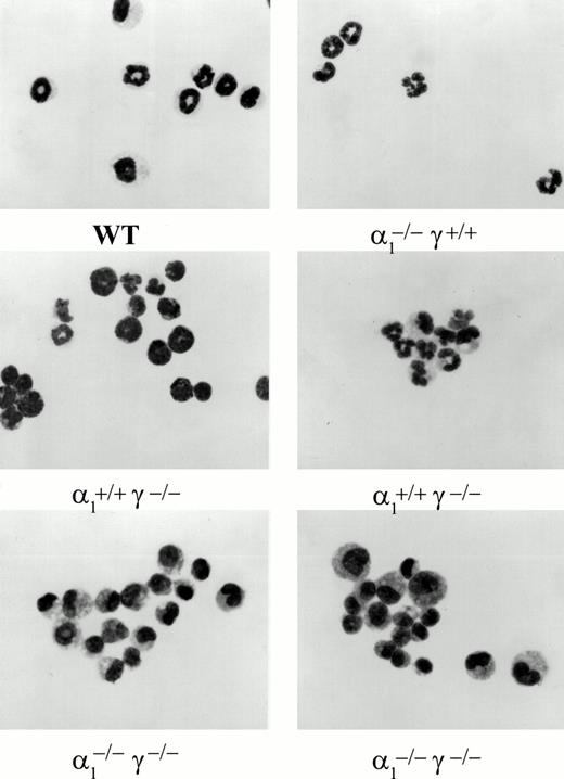 Fig. 4. Light microscopic photographs of colony cells harvested from individual granulocyte macrophage colonies. Colony cells were cytosmeared and stained with Wright-Giemsa. Genotypes are shown underneath.