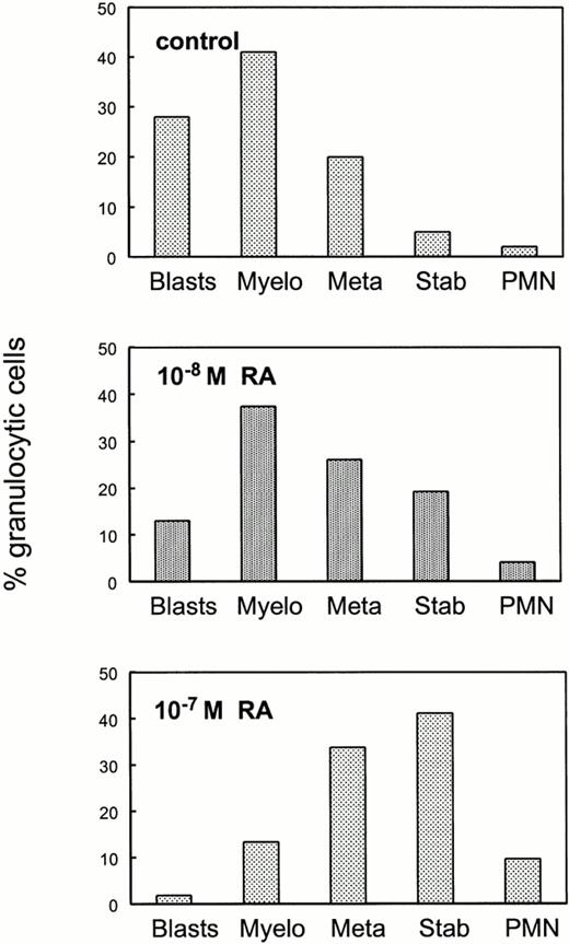 Fig. 7. Pharmacologic doses of RA overcome the maturation block in granulopoietic cells lacking RARα1 and RARγ. Bone marrow cells from RARα1−/−γ−/− mice were plated in methycellulose cultures in the presence or in the absence of RA at the indicated concentrations. GM colonies were harvested individually and stained as in Fig 4. Results shown are the average of differential counts of 30 independent colonies in the control group, three colonies for the lower concentration of RA (10−8 mol/L) and 15 colonies for the higher concentration of RA (10−7 mol/L) and are expressed as percent total cells within the granulocytic lineage.
