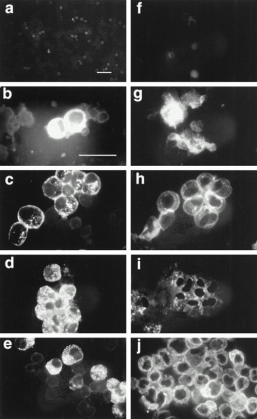 Fig. 2. Immunofluorescent localization of proMBP and MBP in IL-5 induced UCC. UCC were stimulated for 0 to 24 days with 5 ng/mL IL-5. Panels (a to e) show examples of proMBP immunofluorescence on days 0, 6, 12, 18, and 24, respectively. Panels (f to j) show examples of MBP immunofluorescence on days 0, 6, 12, 18, and 24, respectively. Bar (a and f) = 10 μm; bar (b to e) and (g to j) = 10 μm.