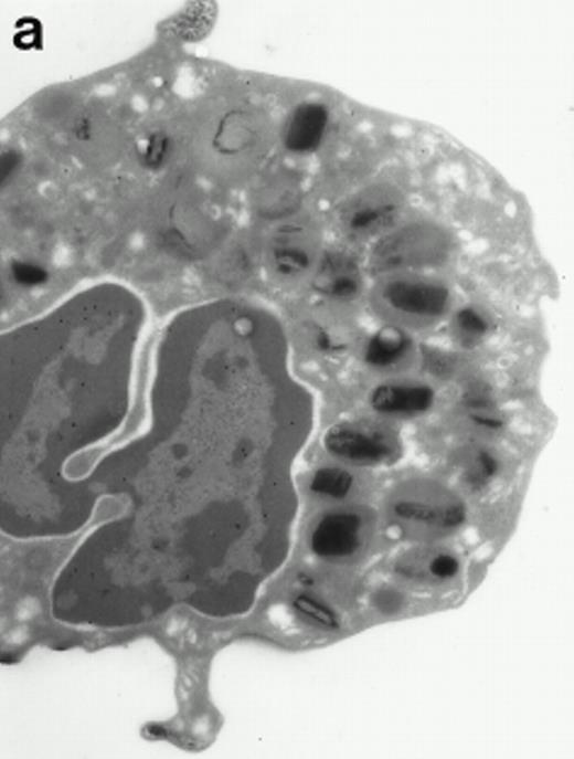 Fig. 6. Localization of proMBP and MBP by immunoelectron microscopy. (a) A peripheral blood eosinophil labeled with anti-proMBP J163-15E10. Note the absence of specific labeling. (b) A peripheral blood eosinophil labeled with rabbit anti-MBP. Note that MBP is specifically localized to the granule crystalline core (black arrows). (c) Day-24 IL-5–induced UCC labeled with anti-proMBP. The black arrow shows localization of proMBP predominantly to the periphery of a condensing granule; very little proMBP is present in the interior of that granule. The white arrow points to a condensed granule, which lacks proMBP label. Also, note the presence of a large uncondensed granule densely labeled with proMBP proximal to the nucleus (open white arrowhead). (d) Day-24 IL-5–induced UCC labeled with anti-MBP. MBP is localized primarily to the interior of condensing granules (black arrows). (a, c, and d) Original magnification ×11,000; (b) ×15,000.