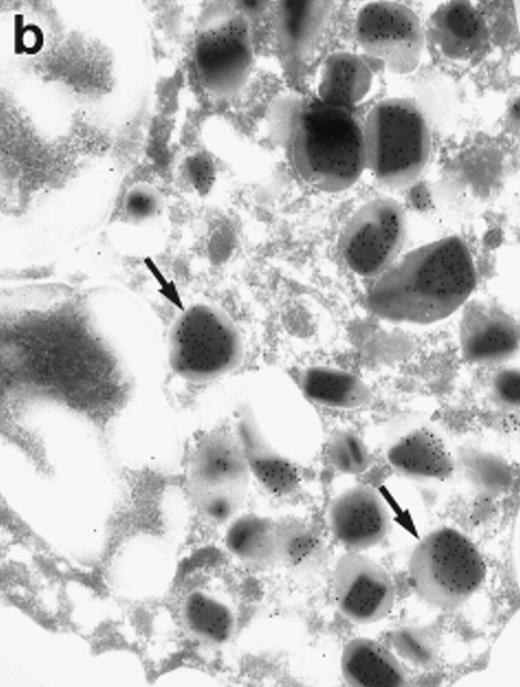 Fig. 6. Localization of proMBP and MBP by immunoelectron microscopy. (a) A peripheral blood eosinophil labeled with anti-proMBP J163-15E10. Note the absence of specific labeling. (b) A peripheral blood eosinophil labeled with rabbit anti-MBP. Note that MBP is specifically localized to the granule crystalline core (black arrows). (c) Day-24 IL-5–induced UCC labeled with anti-proMBP. The black arrow shows localization of proMBP predominantly to the periphery of a condensing granule; very little proMBP is present in the interior of that granule. The white arrow points to a condensed granule, which lacks proMBP label. Also, note the presence of a large uncondensed granule densely labeled with proMBP proximal to the nucleus (open white arrowhead). (d) Day-24 IL-5–induced UCC labeled with anti-MBP. MBP is localized primarily to the interior of condensing granules (black arrows). (a, c, and d) Original magnification ×11,000; (b) ×15,000.
