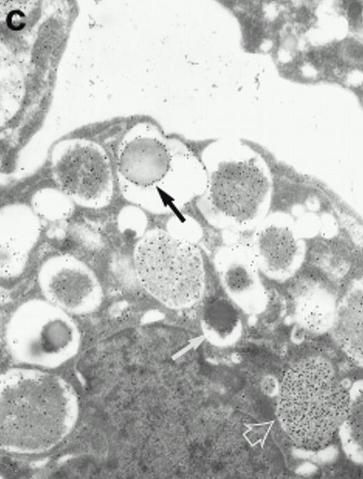 Fig. 6. Localization of proMBP and MBP by immunoelectron microscopy. (a) A peripheral blood eosinophil labeled with anti-proMBP J163-15E10. Note the absence of specific labeling. (b) A peripheral blood eosinophil labeled with rabbit anti-MBP. Note that MBP is specifically localized to the granule crystalline core (black arrows). (c) Day-24 IL-5–induced UCC labeled with anti-proMBP. The black arrow shows localization of proMBP predominantly to the periphery of a condensing granule; very little proMBP is present in the interior of that granule. The white arrow points to a condensed granule, which lacks proMBP label. Also, note the presence of a large uncondensed granule densely labeled with proMBP proximal to the nucleus (open white arrowhead). (d) Day-24 IL-5–induced UCC labeled with anti-MBP. MBP is localized primarily to the interior of condensing granules (black arrows). (a, c, and d) Original magnification ×11,000; (b) ×15,000.