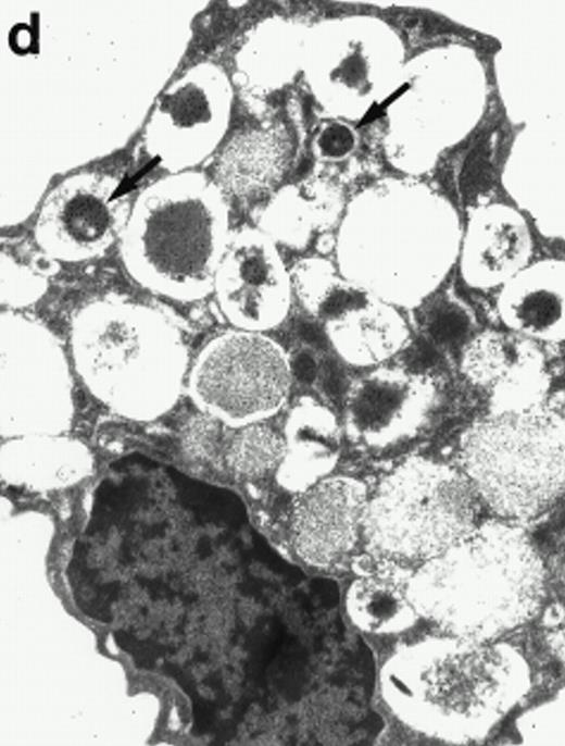Fig. 6. Localization of proMBP and MBP by immunoelectron microscopy. (a) A peripheral blood eosinophil labeled with anti-proMBP J163-15E10. Note the absence of specific labeling. (b) A peripheral blood eosinophil labeled with rabbit anti-MBP. Note that MBP is specifically localized to the granule crystalline core (black arrows). (c) Day-24 IL-5–induced UCC labeled with anti-proMBP. The black arrow shows localization of proMBP predominantly to the periphery of a condensing granule; very little proMBP is present in the interior of that granule. The white arrow points to a condensed granule, which lacks proMBP label. Also, note the presence of a large uncondensed granule densely labeled with proMBP proximal to the nucleus (open white arrowhead). (d) Day-24 IL-5–induced UCC labeled with anti-MBP. MBP is localized primarily to the interior of condensing granules (black arrows). (a, c, and d) Original magnification ×11,000; (b) ×15,000.