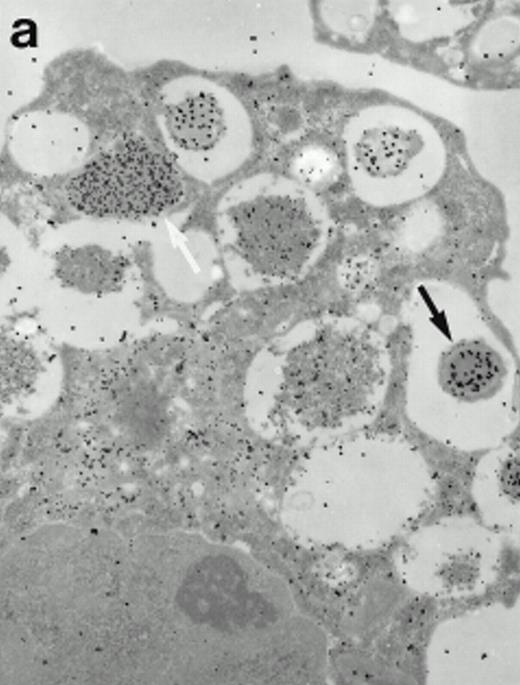 Fig. 7. Localization of proMBP and MBP in day-24 IL-5–induced UCC by immunoelectron microscopy using double labeling. ProMBP was localized with 15-nm colloidal gold particles and MBP with 30-nm gold particles. (a) Although proMBP labeling (small gold) is seen throughout the Golgi, it is concentrated predominantly in the large uncondensed granules (white arrow); only minimal MBP labeling (large gold) is evident in the large granules. In contrast, the small condensed granules show marked MBP labeling in the interior and minimal proMBP labeling at the periphery (black arrow). (b) At higher magnification, dense labeling for proMBP (small gold) and minimal labeling for MBP (large gold) is evident in a large uncondensed granule (white arrow). The black arrow identifies a small condensed granule that contains predominantly MBP, along with minimal proMBP at the periphery. (a) Original magnification ×11,000; (b) ×20,000.